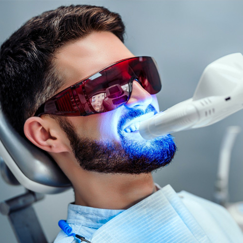 Profesionalus dantų balinimas | Odontologijos klinika Šiauliuose